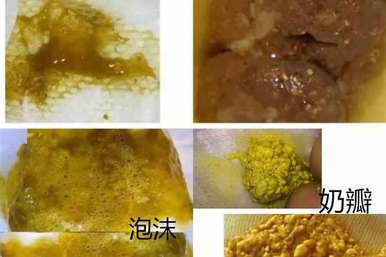 尿屎一起拉运势不好吗？