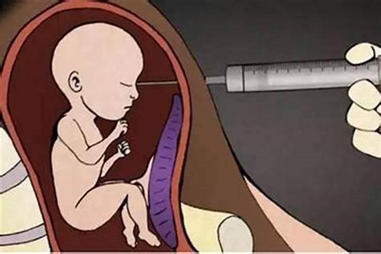 女人堕胎后需要超度吗？