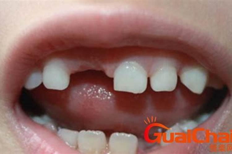 梦见掉牙怎么破解？