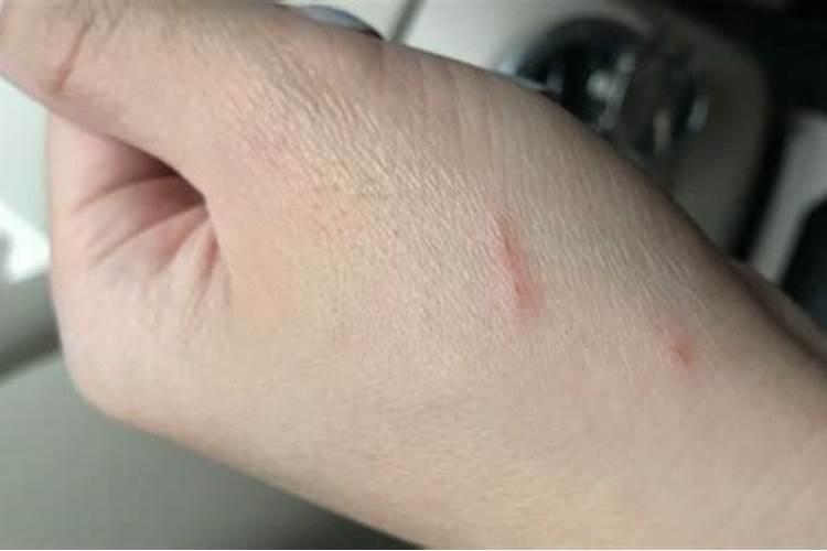 梦到被猫扑上来咬伤了手