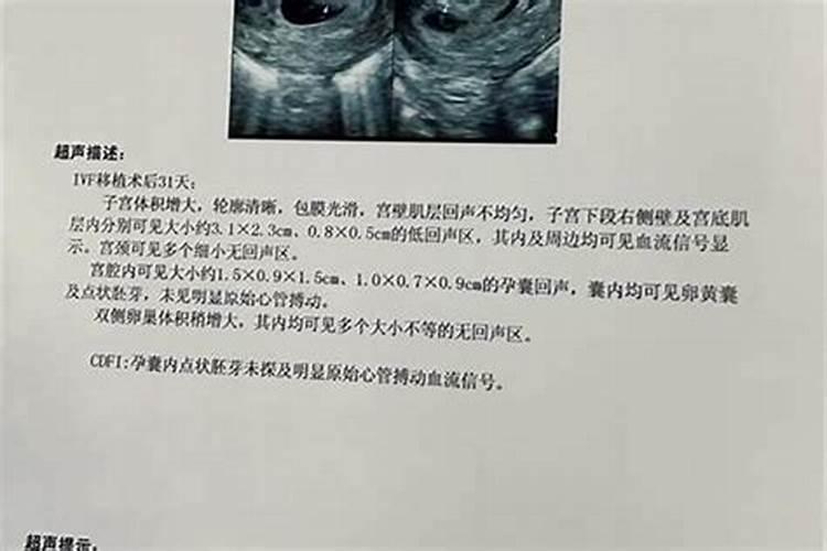 打完胎做法事