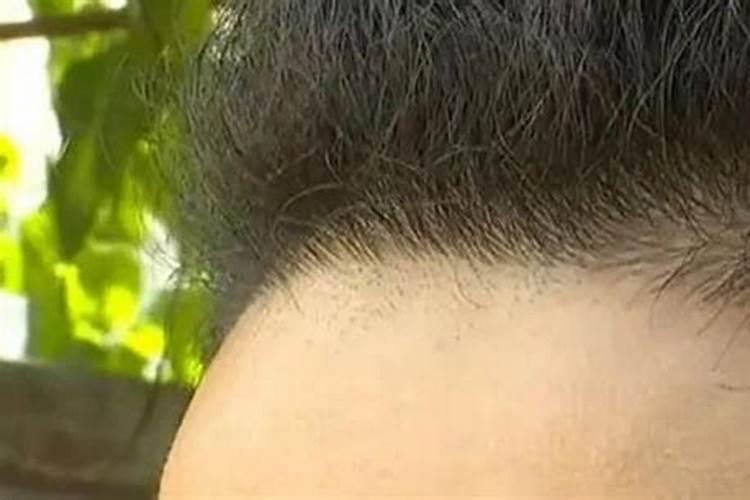刮了发际线会影响运势吗？