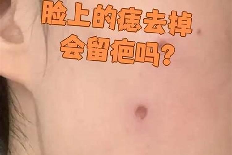 把脸上的痣去掉会影响运势吗？