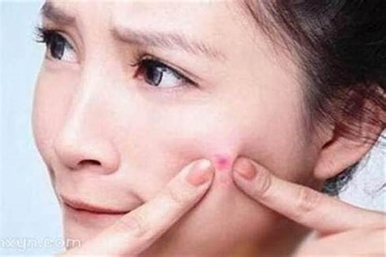 梦到自己脸上长痘痘是什么意思？