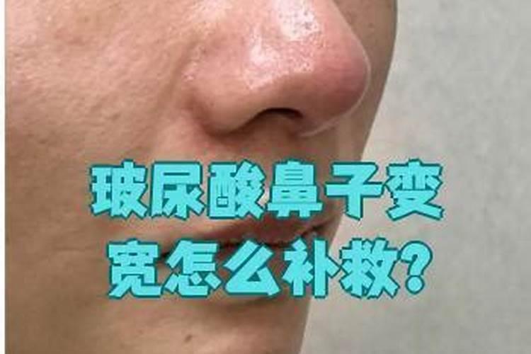 鼻子漏财怎么补救？