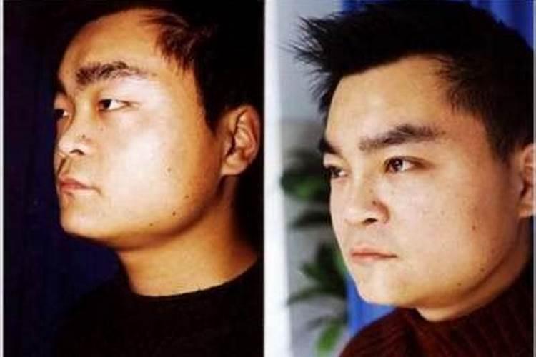 男人塌鼻子婚姻不顺