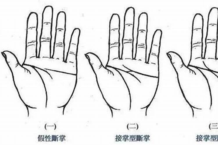 断掌能与断掌合婚吗？