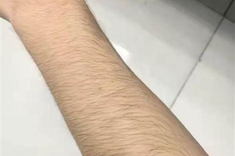 脱手毛会影响运势吗？