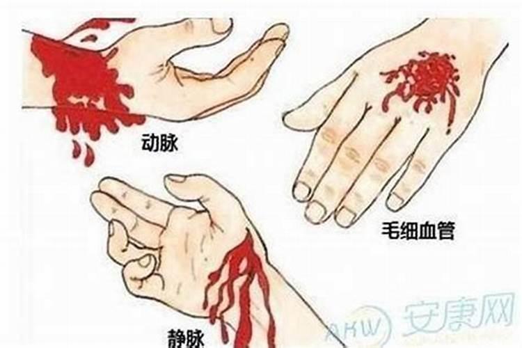 梦见手割了个大深口子流血