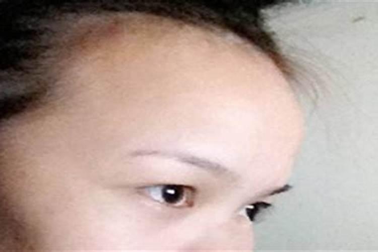 额头太高的女人命好吗？