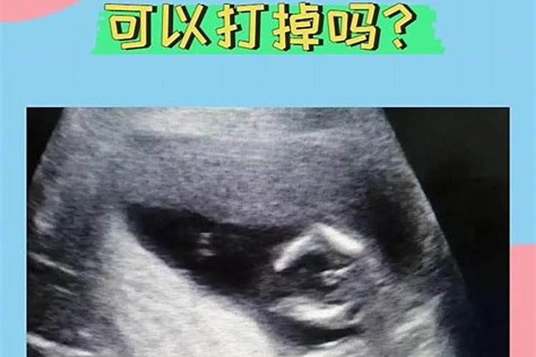 怀孕4个月能打掉吗？