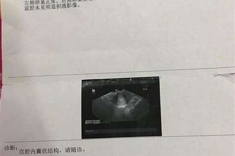 药流的宝宝要怎么样做法事？