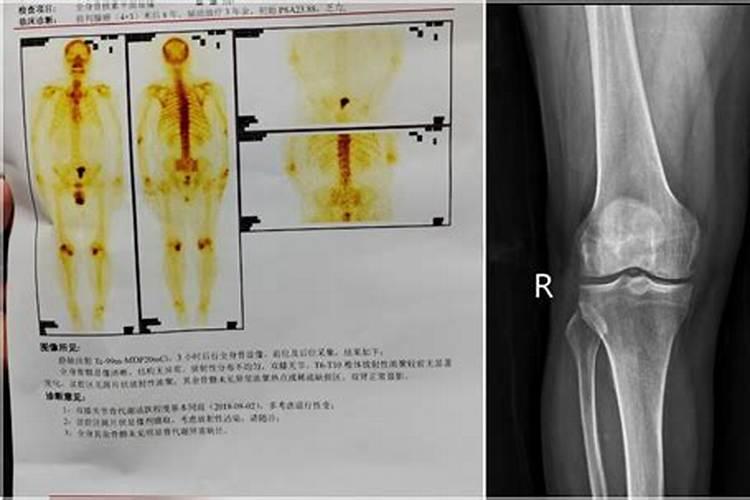 为老人祛病做法事