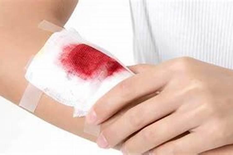 梦见手受伤流血不止是什么意思？