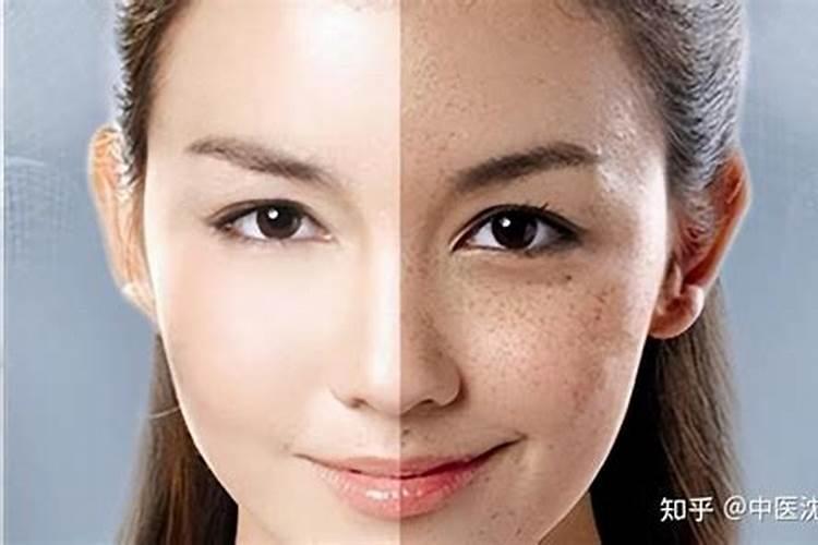 一满脸斑影响运势吗？