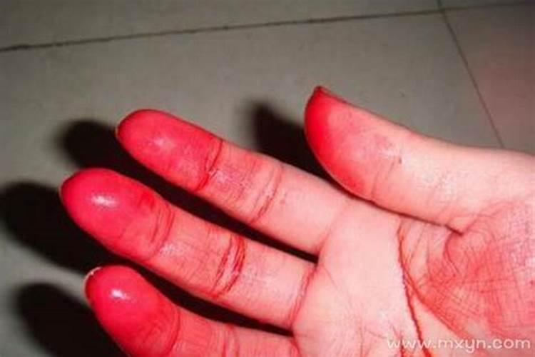 梦见手流血了周公解梦