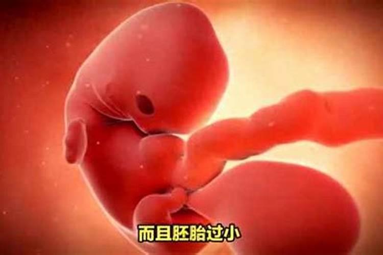 怀孕多长时间堕胎最合适？