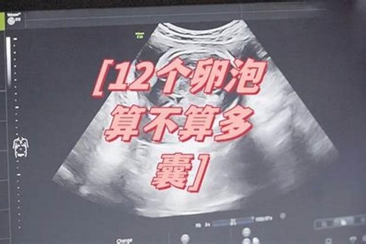 孕囊算不算有生命