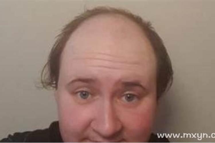 梦到自己秃头是什么预兆男生？