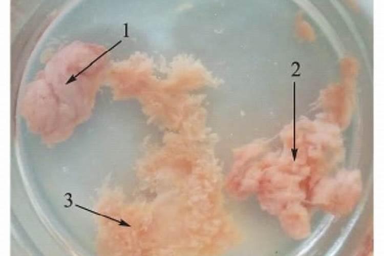 埋流产下来的胚胎