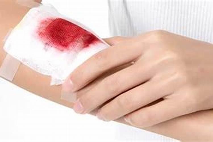 梦到别人受伤流血是什么征兆？