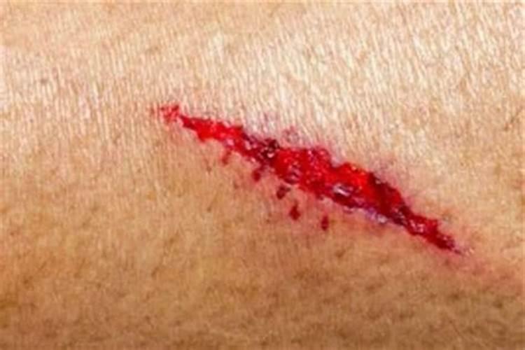 梦见被刀划脚却没出血了