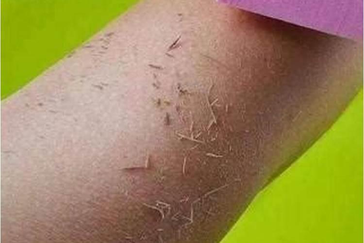 身上有脏东西的表现