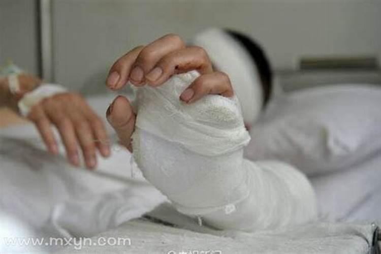 梦见别人的手被砍掉是什么意思？