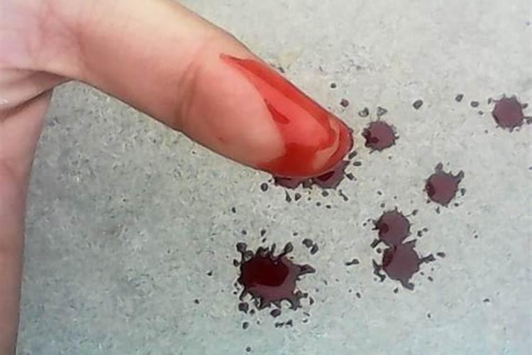 梦见手被割破流好多血？