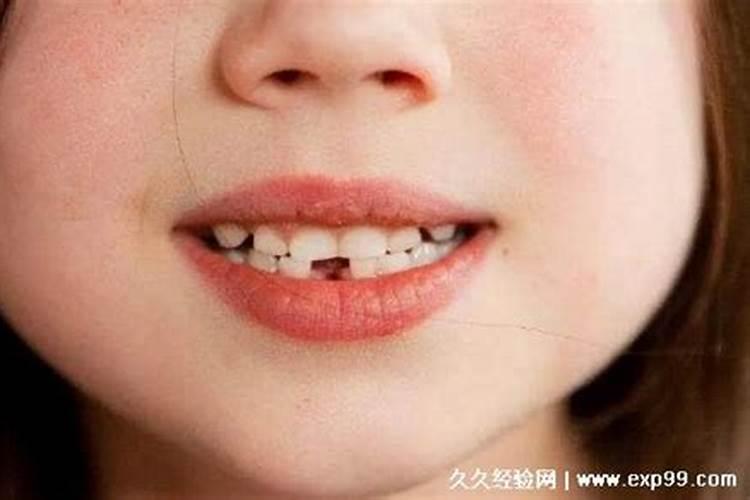 梦见掉牙的科学解释